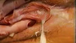 Patyręs trematode atneša vyras Orgazmas Su Savo Burną
